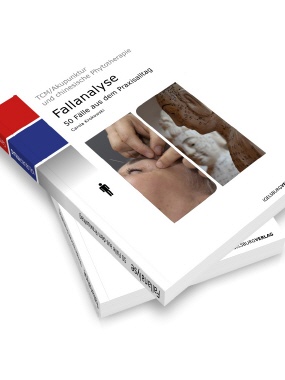 Fallanalyse (human)